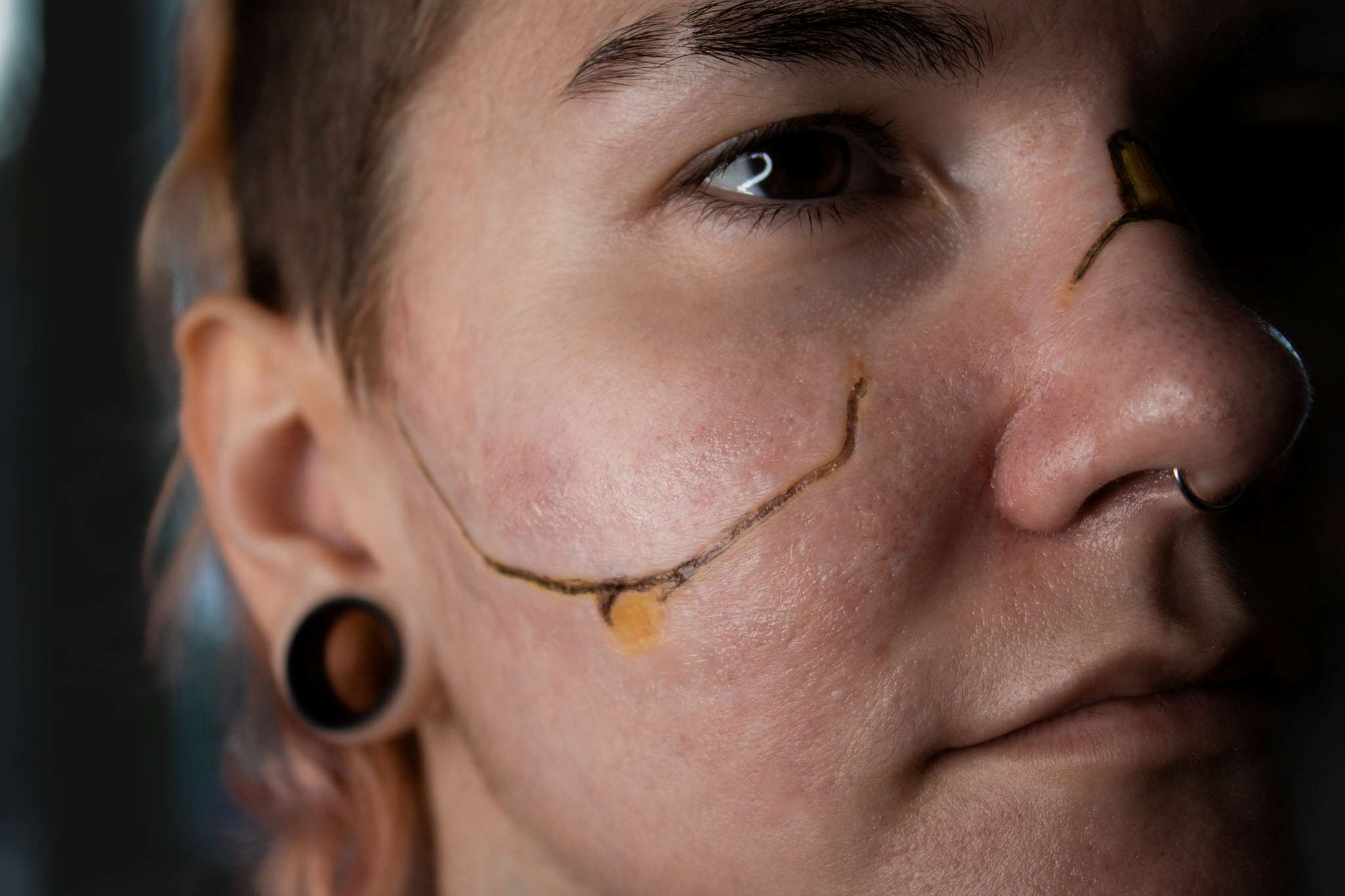 HD Prosthetics