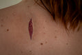 Stichwunde A - HD Prosthetics