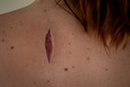 Stichwunde A - HD Prosthetics