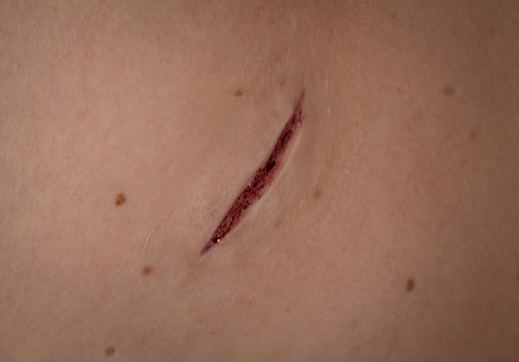Stichwunde B - HD Prosthetics