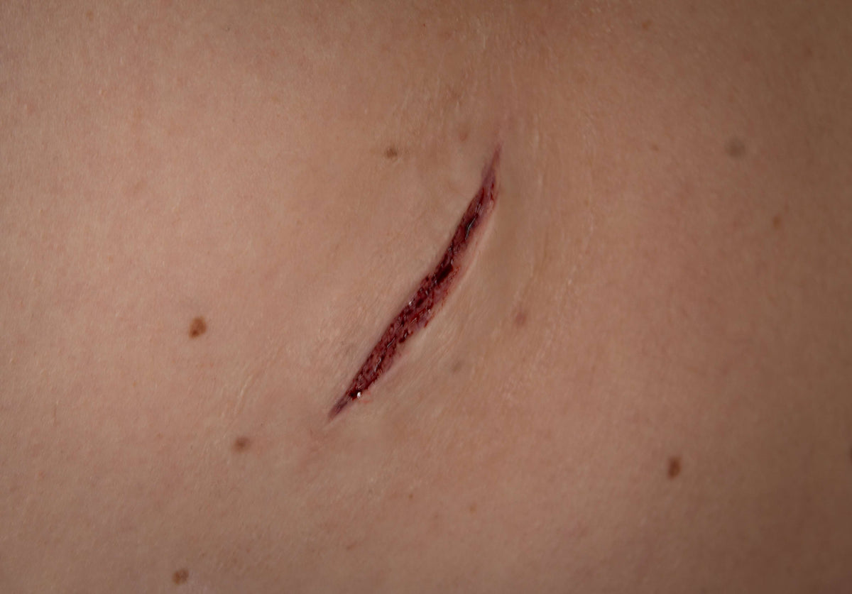 Stichwunde B - HD Prosthetics